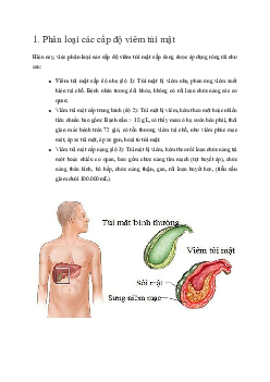 Các mức độ viêm túi mật cấp tính và biện pháp chẩn đoán