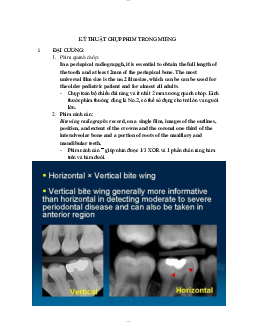 Tài liệu kỹ thuật chụp phim trong miệng/Đại học y dược Huế