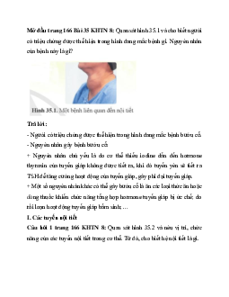 Giải Khoa học tự nhiên 8 bài 35: Hệ nội tiết ở người | Cánh diều