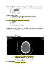 Trắc nghiệm Chẩn Đoán và Xử Trí Chấn Thương Sọ Não | Đại học Y khoa Phạm Ngọc Thạch
