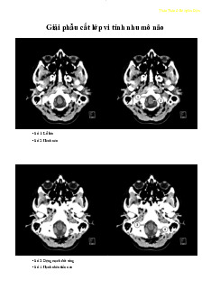 Giải phẫu cắt lớp vi tính nhu mô não môn Giải phẫu | Trường Đại Học Y Dược Thái Bình