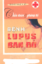 Chẩn đoán & phòng trị Bệnh Lupus ban đỏ