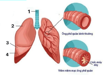 Chi tiết số 4 là: (ảnh 1)